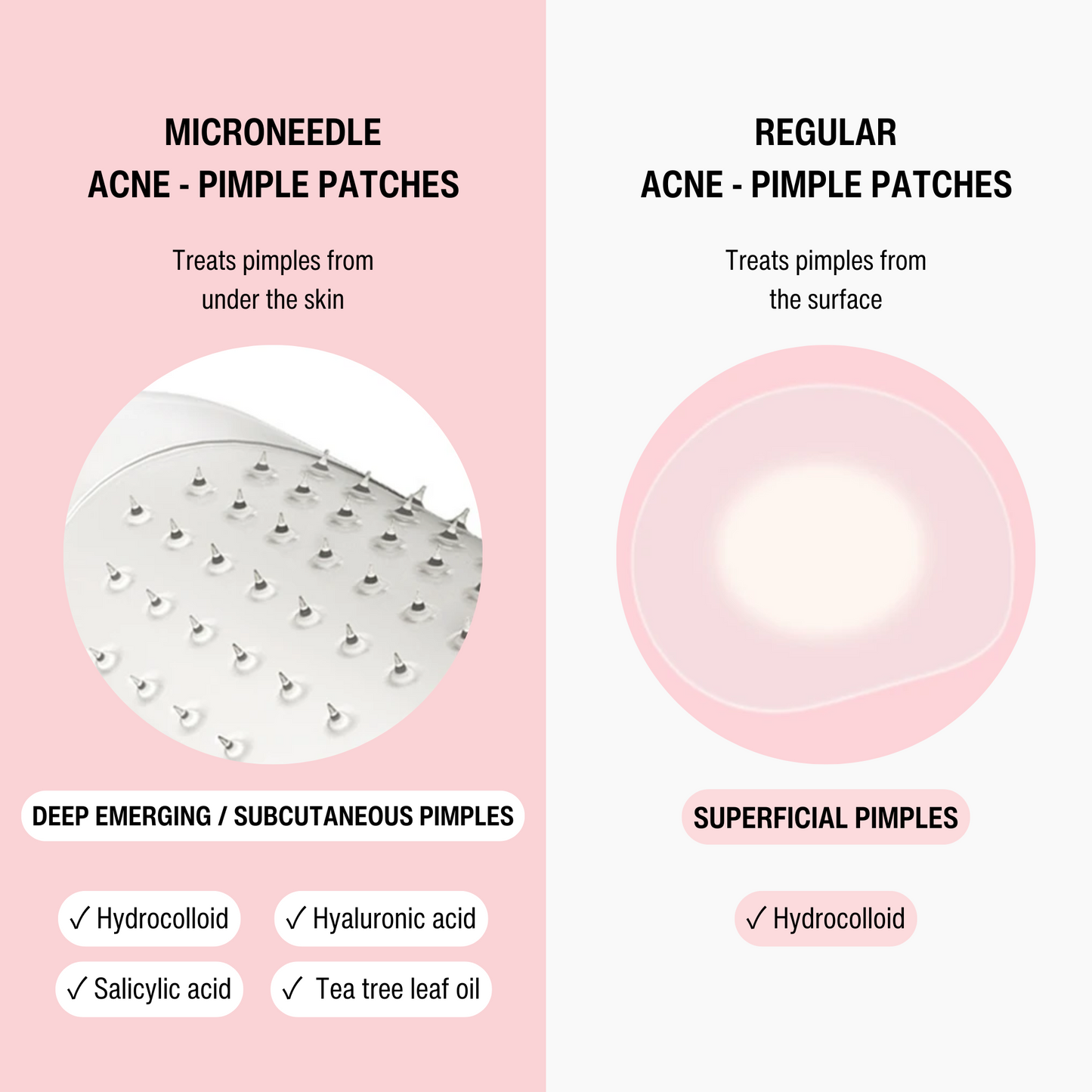 MICRONEEDLE ACNE - PIMPLE PATCH
