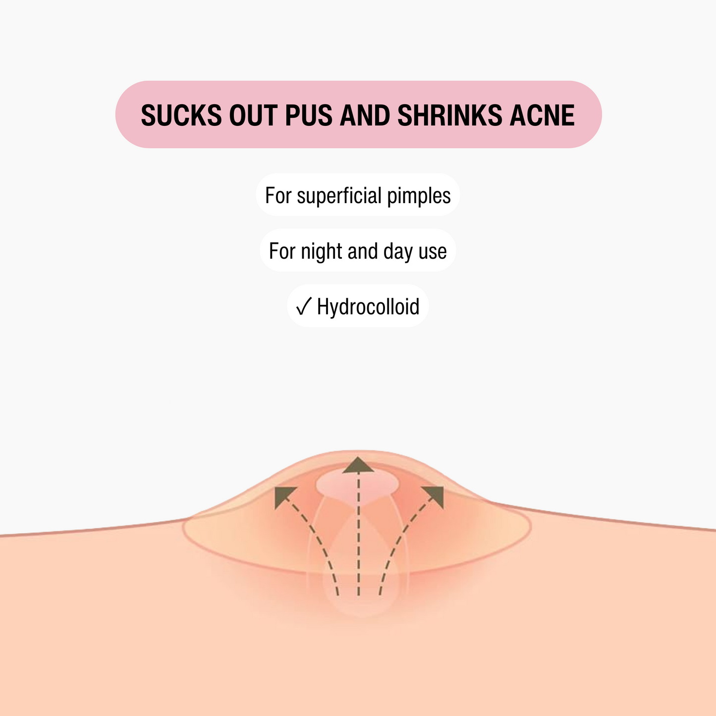 REGULAR ACNE - PIMPLE PATCH