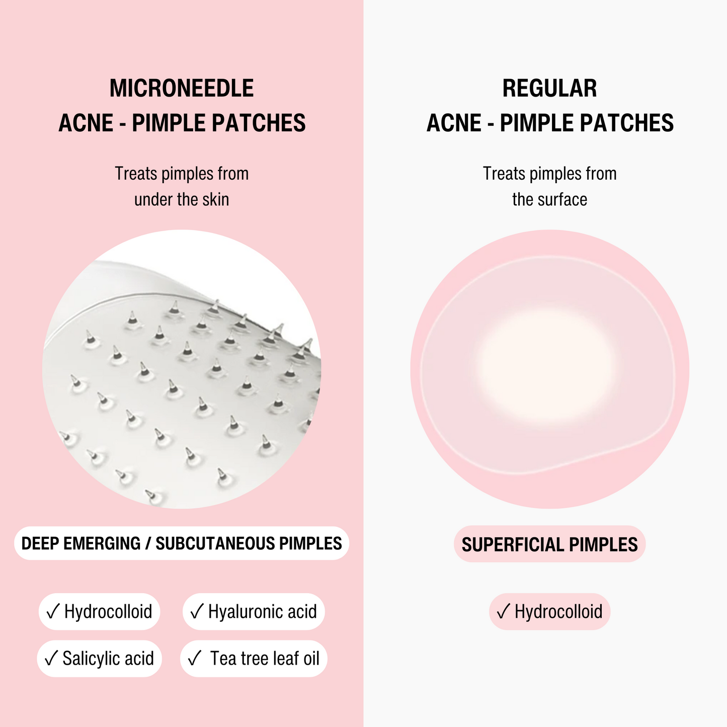 REGULAR ACNE - PIMPLE PATCH